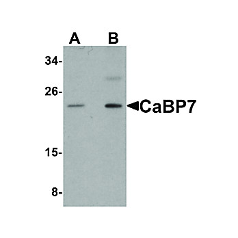 Anti-CaBP7 (RABBIT) Antibody, 100µg, Liquid (sterile filtered)