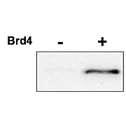 Anti-Cyclin-Dependent Kinase 9 (CDK9) pT29 [RABBIT] Antibody, 100µg, Liquid (sterile filtered)