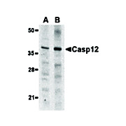Anti-Caspase-12 (Small) (RABBIT) Antibody, 100µg, Liquid (sterile filtered)