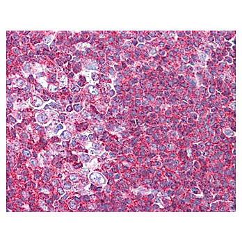 Anti-Sipa1 (RABBIT) Antibody, 100µg, Liquid (sterile filtered)