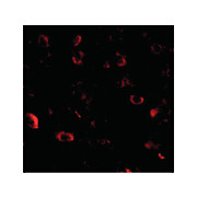 CAPS1 nterm Antibody 100µg