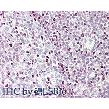 Anti-CTCF (RABBIT) Antibody, 100µg, Liquid (sterile filtered)