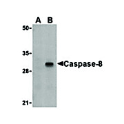 Caspase-8 Antibody 100µg