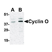 Cyclin O Antibody internal 100µg
