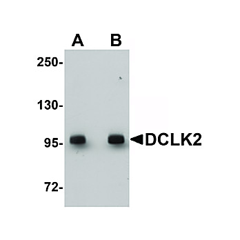 Anti-DCLK2 (RABBIT) Antibody, 100µg, Liquid (sterile filtered)