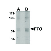 Anti-FTO (RABBIT) Antibody, 100µg, Liquid (sterile filtered)