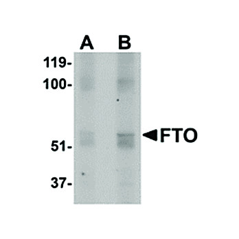 Anti-FTO (RABBIT) Antibody, 100µg, Liquid (sterile filtered)