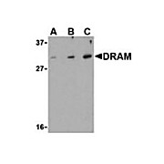 Anti-Damage Related Autophagy Modulator (RABBIT) Antibody, 100µg, Liquid (sterile filtered)