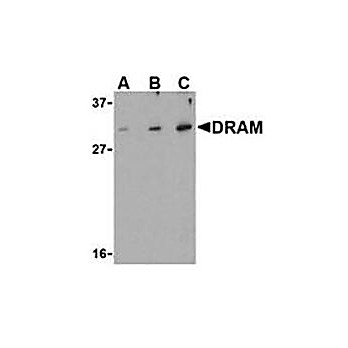 Anti-Damage Related Autophagy Modulator (RABBIT) Antibody, 100µg, Liquid (sterile filtered)