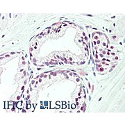 Anti-Transcription Initiation Factor TFIID Subunit 1 (TAF1) (RABBIT) Antibody, 100µg, Liquid (sterile filtered)