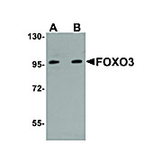 Anti-FOXO3 (RABBIT) Antibody, 100µg, Liquid (sterile filtered)