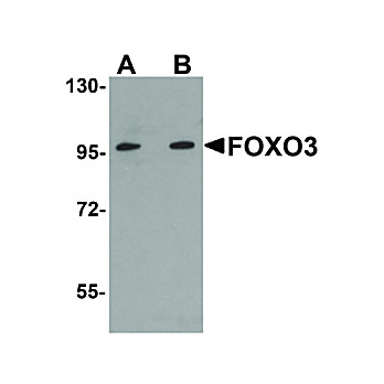 Anti-FOXO3 (RABBIT) Antibody, 100µg, Liquid (sterile filtered)