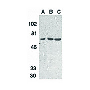 DcR1 Antibody 100µg