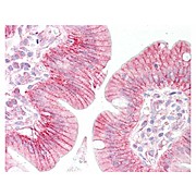 Anti-beta Catenin (RABBIT) Antibody, 25µL, Liquid (sterile filtered)