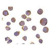 Anti-Death Receptor 4 (DR4) (RABBIT) Antibody, 100µg, Liquid (sterile filtered)