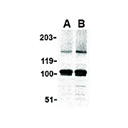Anti-IKAP (RABBIT) Antibody, 100µg, Liquid (sterile filtered)