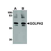 Anti-GOLPH2 (RABBIT) Antibody, 100µg, Liquid (sterile filtered)