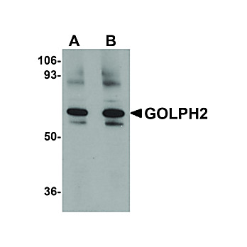 Anti-GOLPH2 (RABBIT) Antibody, 100µg, Liquid (sterile filtered)