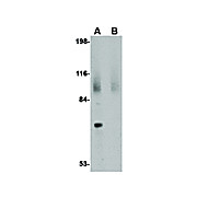 JPH2 Antibody 14 cterm 100µg