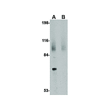JPH2 Antibody 14 cterm 100µg