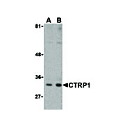 CTRP1 Antibody internal 100µg
