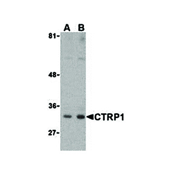 CTRP1 Antibody internal 100µg