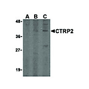 CTRP2 Antibody internal 100µg