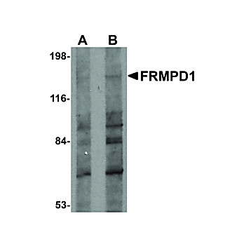 Anti-FRMPD1 (RABBIT) Antibody, 100µg, Liquid (sterile filtered)