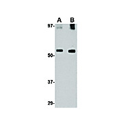 Anti-GDF6 (RABBIT) Antibody, 100µg, Liquid (sterile filtered)