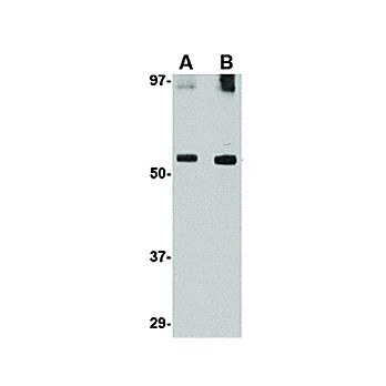 Anti-GDF6 (RABBIT) Antibody, 100µg, Liquid (sterile filtered)