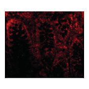 Anti-CDKN2A (RABBIT) Antibody, 100µg, Liquid (sterile filtered)