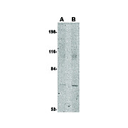 Anti-JPH1 (RABBIT) Antibody, 100µg, Liquid (sterile filtered)