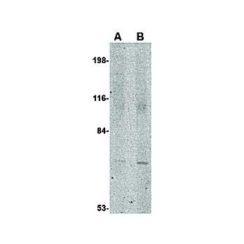 Anti-JPH1 (RABBIT) Antibody, 100µg, Liquid (sterile filtered)