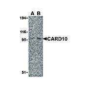 Anti-CARD10 (RABBIT) Antibody, 100µg, Liquid (sterile filtered)