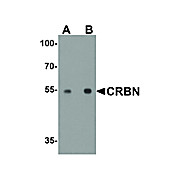 Anti-CRBN (RABBIT) Antibody, 100µg, Liquid (sterile filtered)
