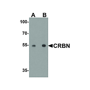 Anti-CRBN (RABBIT) Antibody, 100µg, Liquid (sterile filtered)