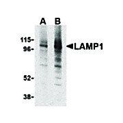 Anti-LAMP1 (RABBIT) Antibody, 100µg, Liquid (sterile filtered)