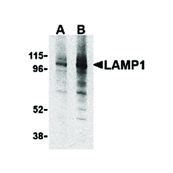 Anti-LAMP1 (RABBIT) Antibody, 100µg, Liquid (sterile filtered)