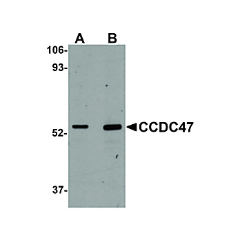 CCDC47 cterm Antibody 100µg