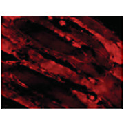 IL-31 Antibody internal 100µg