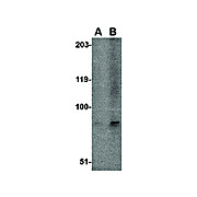 EVER1 Antibody nterm 100µg