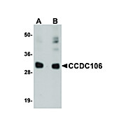 Anti-CCDC106 (RABBIT) Antibody, 100µg, Liquid (sterile filtered)