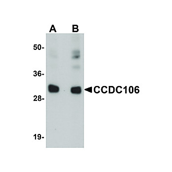 Anti-CCDC106 (RABBIT) Antibody, 100µg, Liquid (sterile filtered)