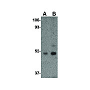 Carabin cterm Antibody 100µg