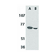 Anti-F1A alpha (RABBIT) Antibody, 100µg, Liquid (sterile filtered)