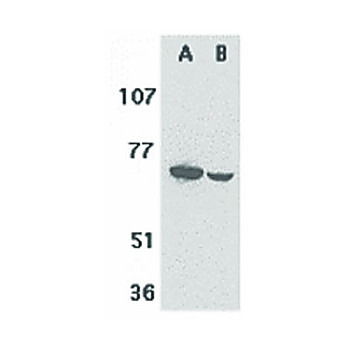 Anti-F1A alpha (RABBIT) Antibody, 100µg, Liquid (sterile filtered)