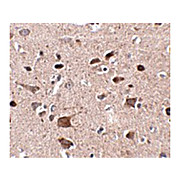 Anti-CCDC134 (RABBIT) Antibody, 100µg, Liquid (sterile filtered)