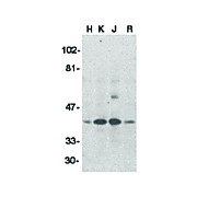 DFF40 Antibody 100µg