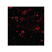 CAPS1 cterm Antibody 100µg