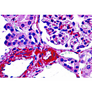 Anti-CARMA3 (RABBIT) Antibody, 100µg, Liquid (sterile filtered)